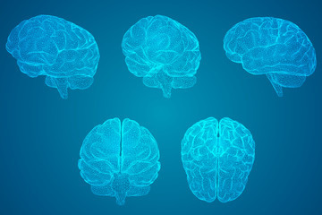 汽车显示abs和刹车灯一直亮是什么原因